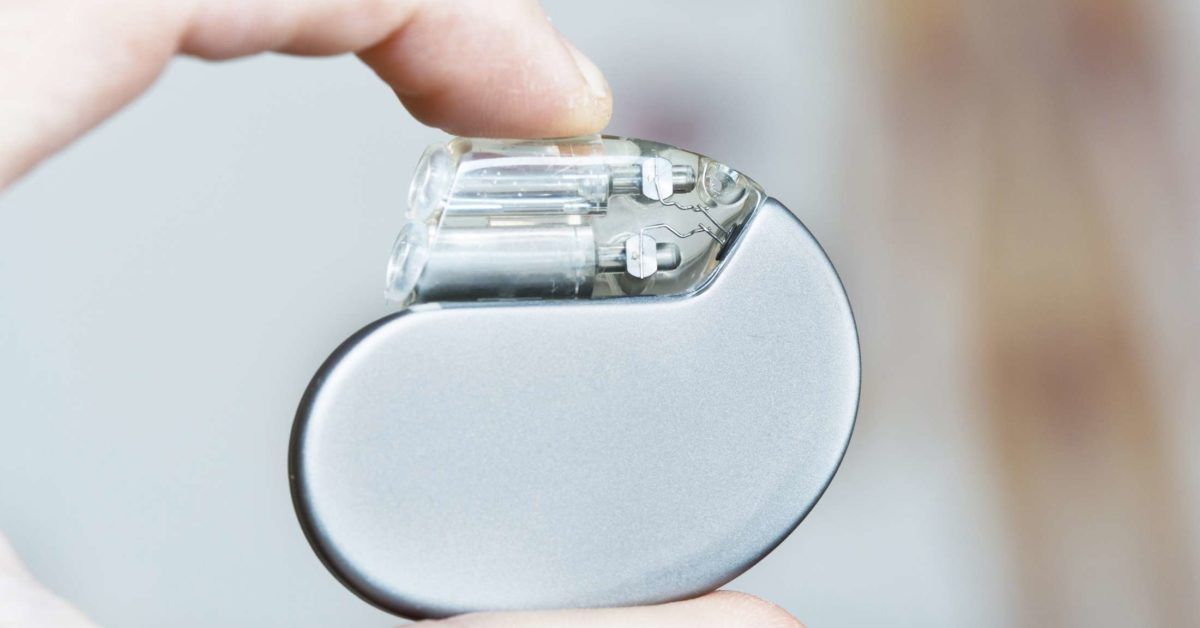 Heart pacemaker surgery: Purpose, procedure, and risks