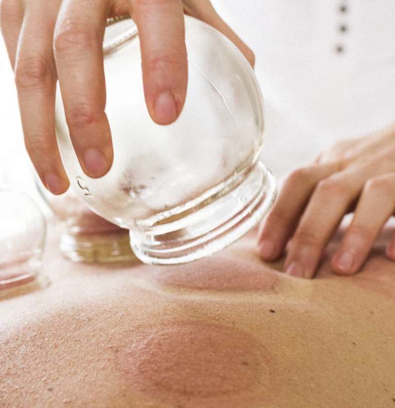 Cupping therapy: Benefits, how to do it at home, and side effects