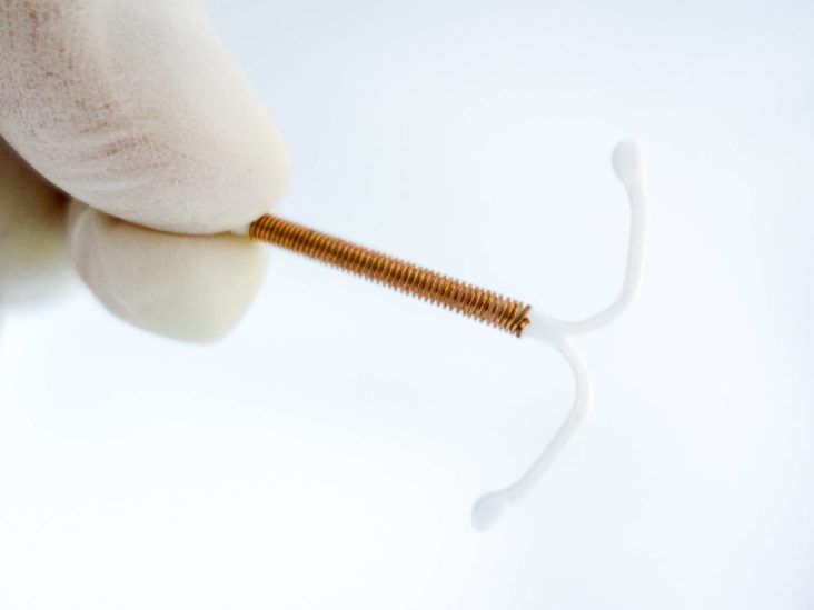 IUD insertion A guide and what to expect 