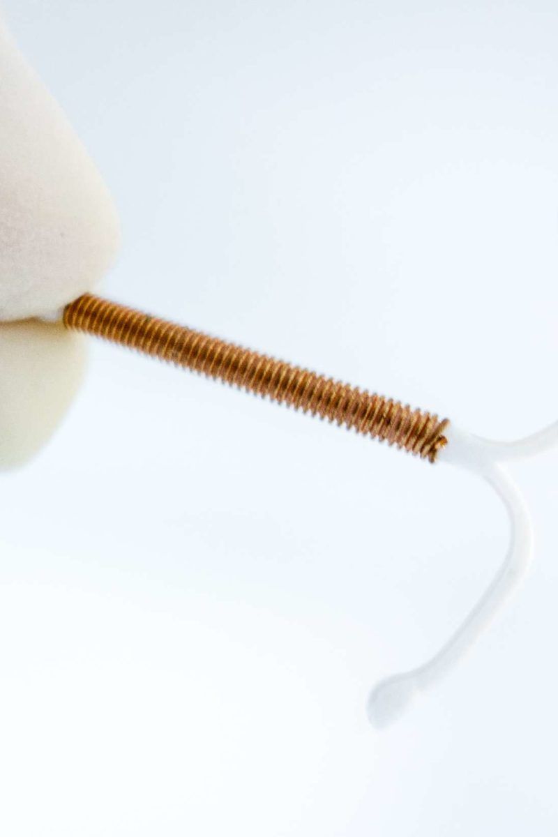 IUD insertion A guide and what to expect 