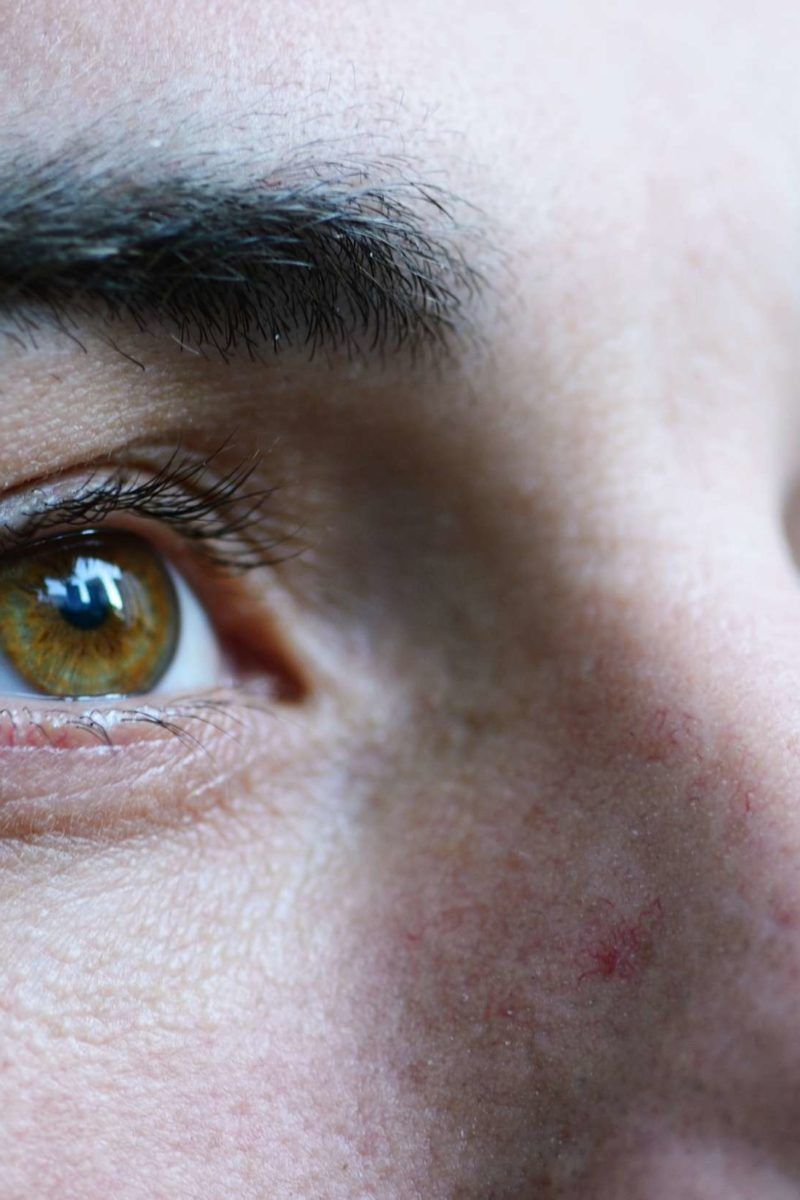 How does MS affect vision? Eye symptoms and treatment