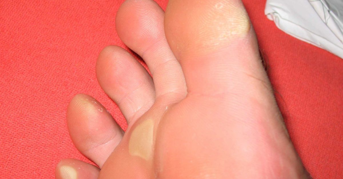 What Your Toenail Color May Suggest About Your Health - The Dermatology  Clinic