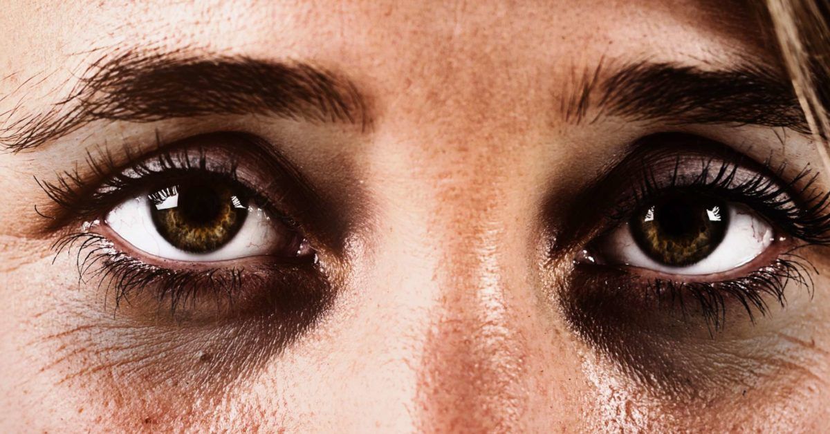 9 Causes of Dark Eye Circles - Take action to reduce dark circles under eyes  with natural, noninvasive methods - Blissoma Botanical Beauty