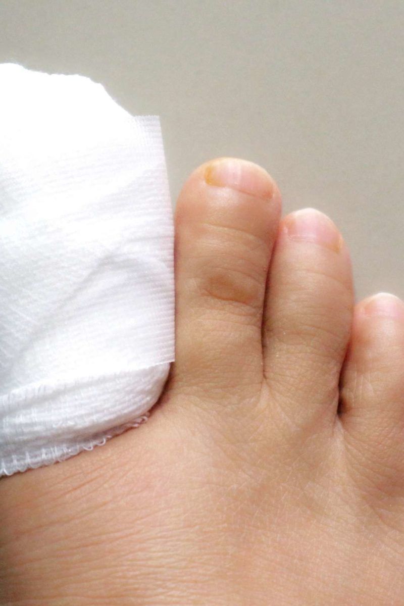 What are the Symptoms of Ingrown Toenail & their Treatment by Podiatry  Centers - Issuu