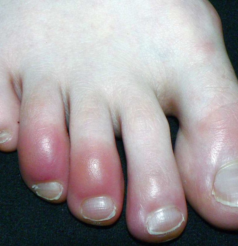 People Are Just Now Learning The Purpose Of The Pinky Toe