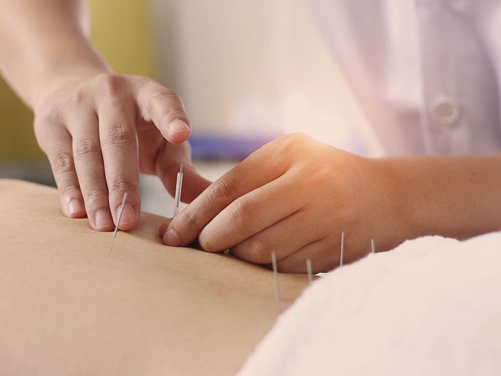 South Kensington Acupuncture, London