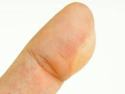 kola loka on my finger it hurts and start burn my sking : r/CleaningTips