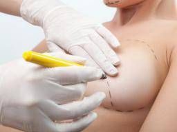 Implant bottoming out  Brisbane Plastic & Cosmetic Surgery
