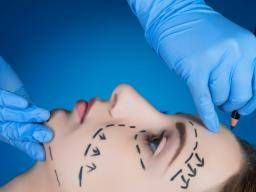 Face-Lift (rhytidectomy) - Conditions & Treatments