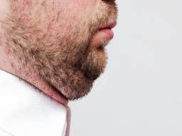 How to get discount rid of round chin