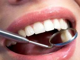 Mastagi Roomi Khane Ke ASAL Fawaid! Mastic Gum Benefits