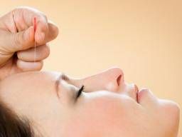 Pre-dementia memory loss improved with acupuncture