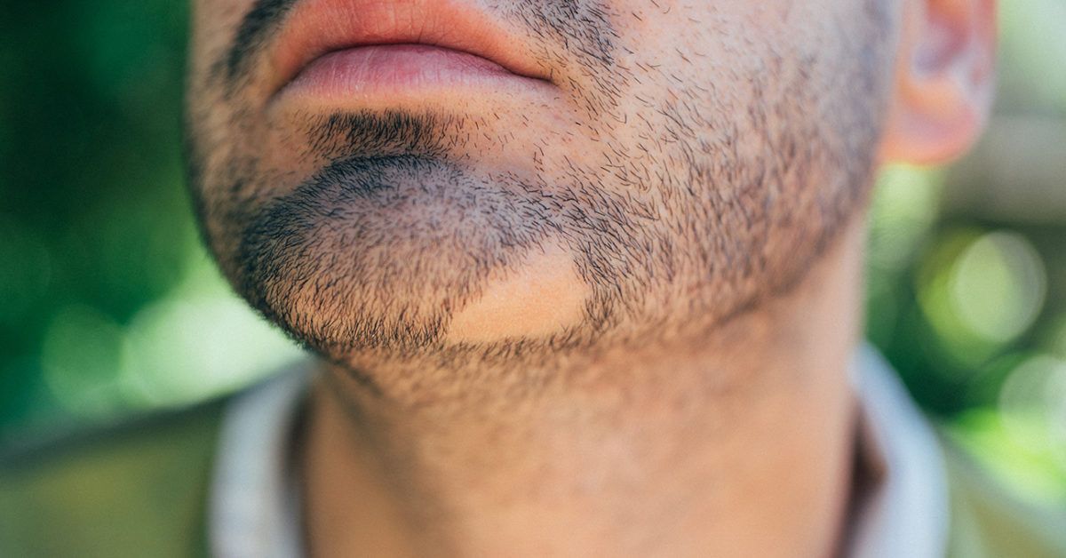 How to treat dry skin under your beard