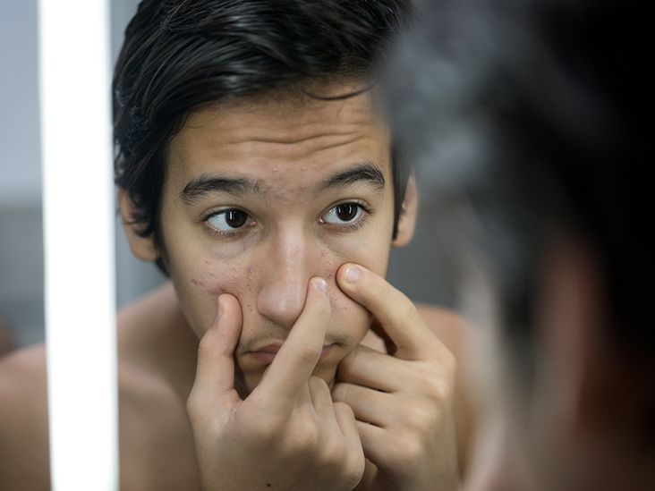 Does smoking weed cause acne?