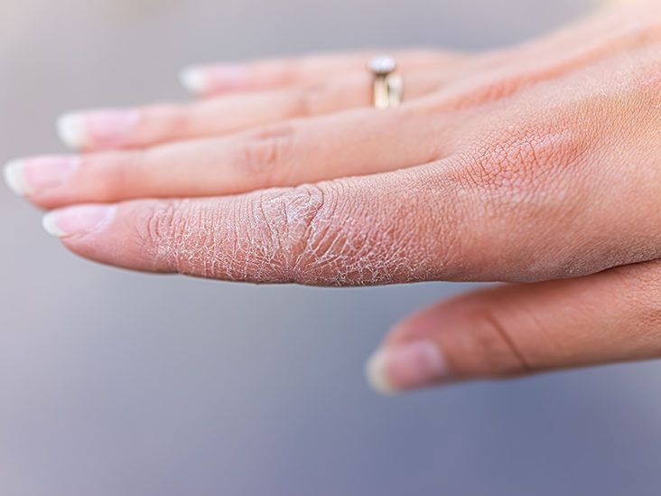 What does it mean when a woman wears a thumb ring? - Quora