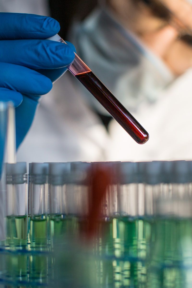 Blood test can detect 50 different types of cancer