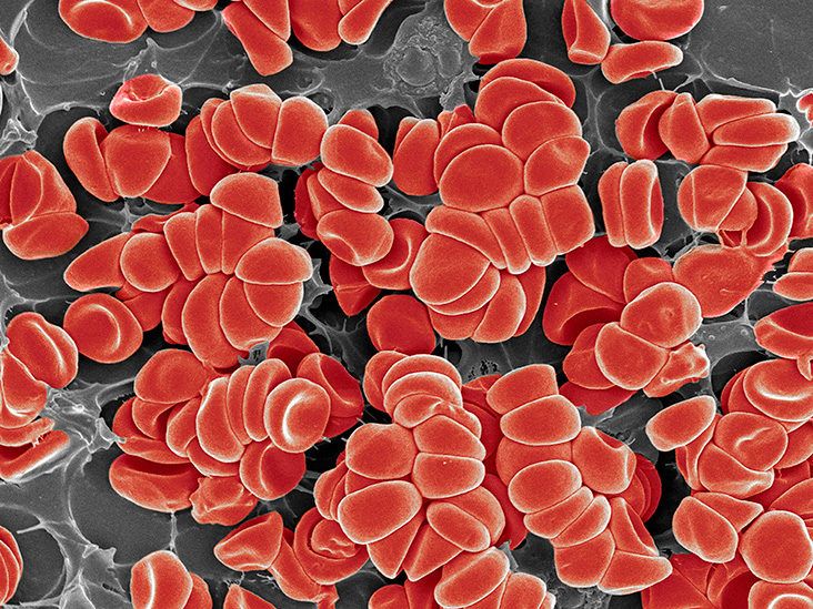 Genetic Risk for Fatal Blood Clots in IBD Patients
