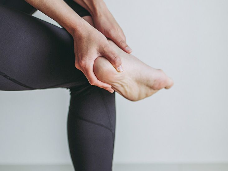 Can you get rid of heel spurs? Treatment options and exercises
