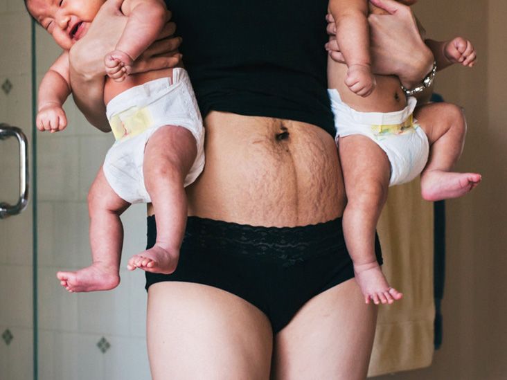 6 Women Reveal What It's Really Like Post-Pregnancy