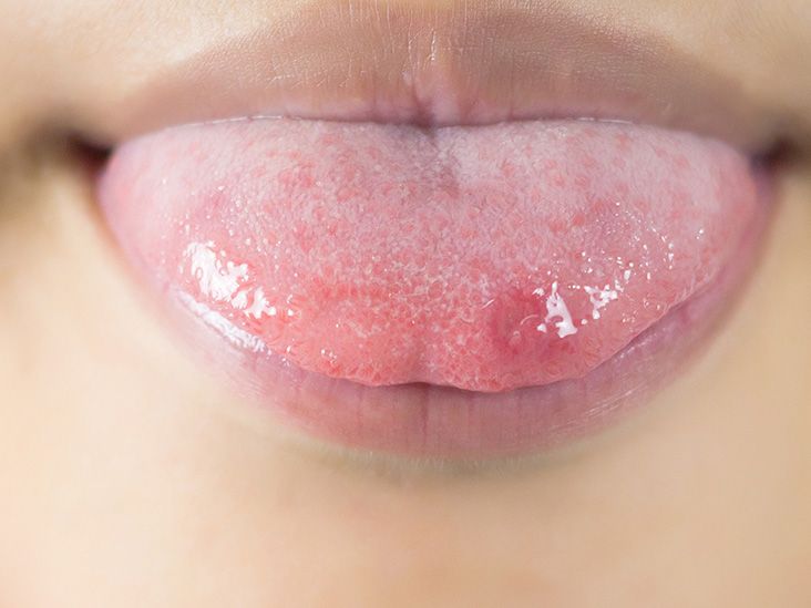 lipglossssssssss #coco #Tongue #dentistry #tiktokcreators #tiktokcrea... |  TikTok