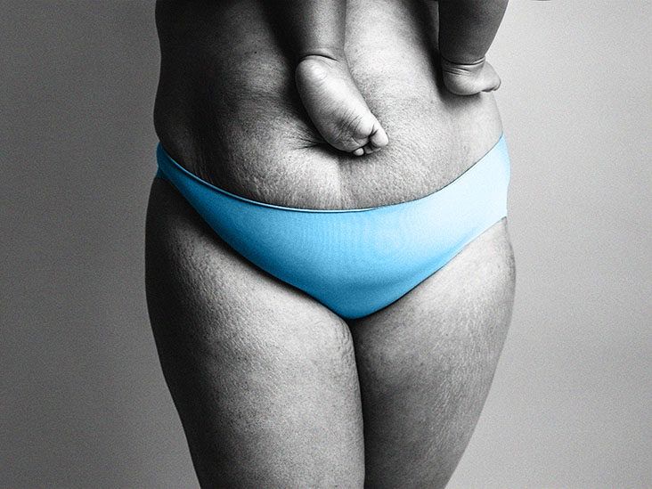 Firm Compression Adjustable Velcro Belly Wrap Postpartum Panty