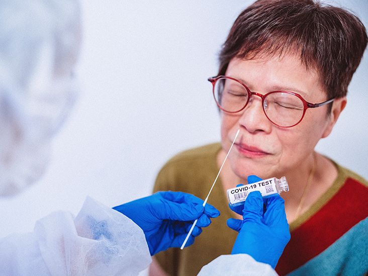 Does Medicare cover coronavirus antibody test costs?