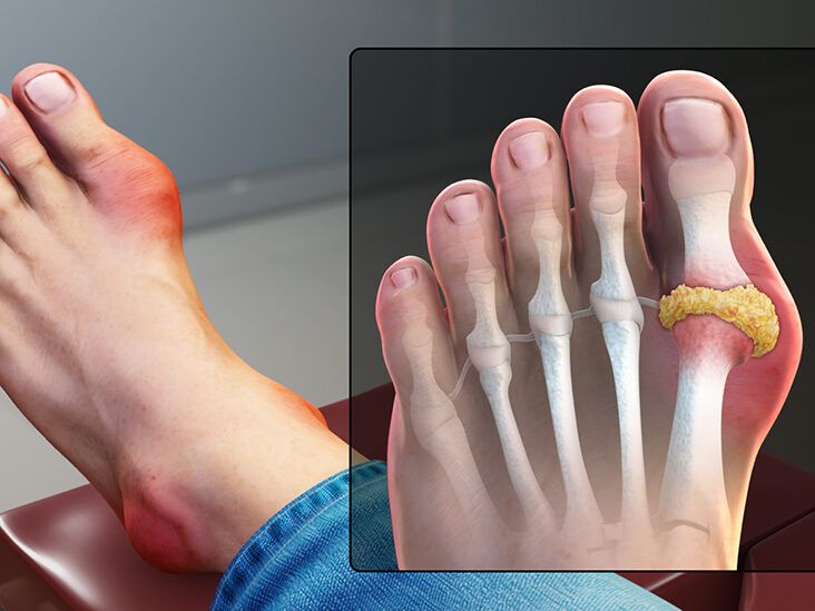 The Most Common Causes of Foot Pain and How to Treat It
