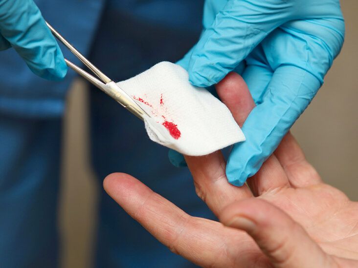 Close Up Female Arms Cutting Cuticle From Girl Thumb. Profession