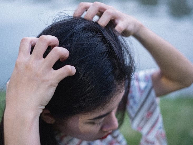 Itchy scalp Causes, symptoms, and treatment