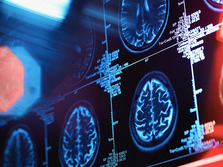 www.medicalnewstoday.com