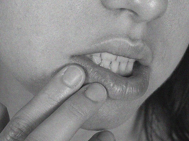 Itchy lips: Causes, symptoms, treatment options, and more