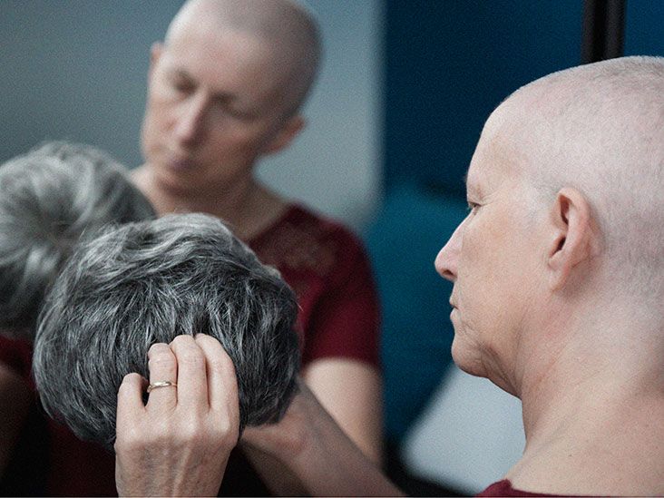 cancer-care-does-medicare-cover-wigs-for-cancer-patients