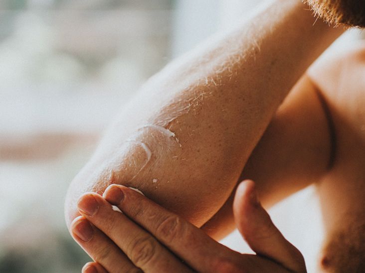Psoriasis and HIV: What is the link?