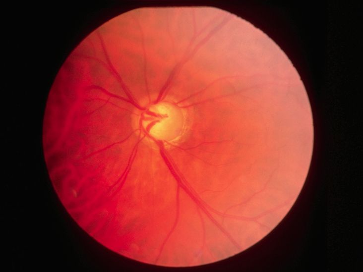 Types, causes, and symptoms