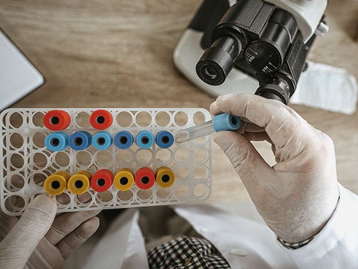 vldl-cholesterol-risks-healthy-levels-treatment-and-more