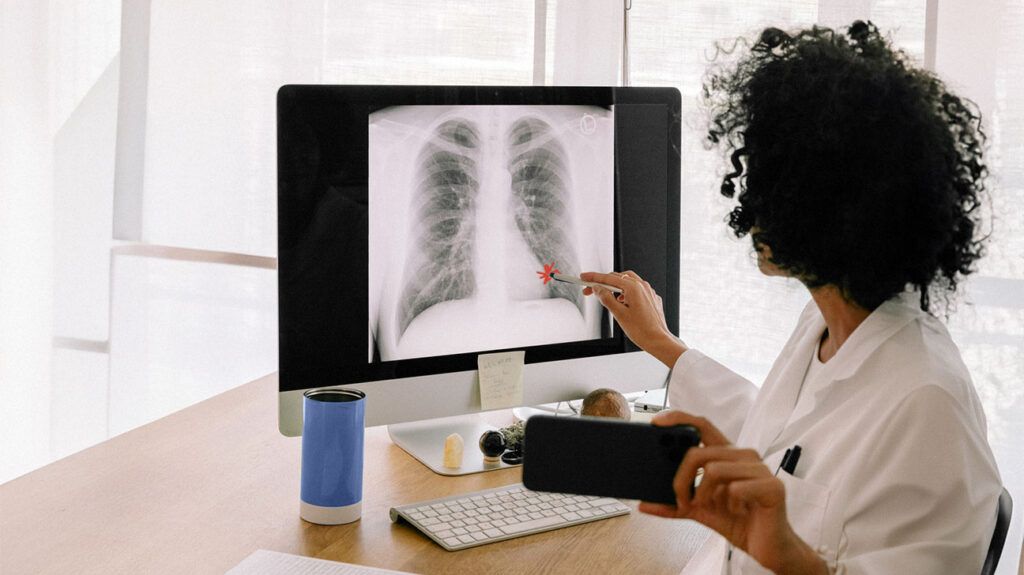 a doctor looking at a lung scan on a computer screen
