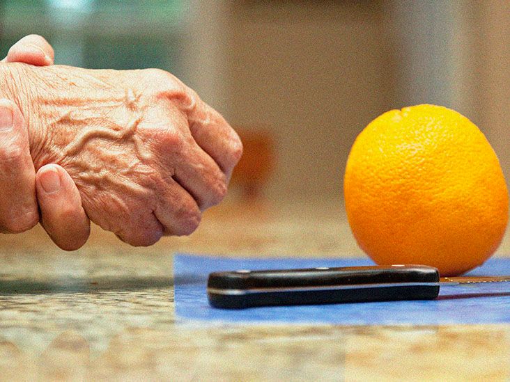 Parkinson's life expectancy Stages and treatment options