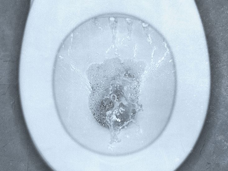 TMI POST* White particles in urine during early pregnancy (approx
