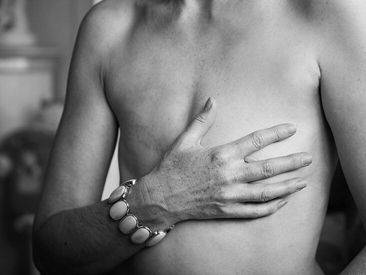 Breast prostheses: Types, cost, and how to choose