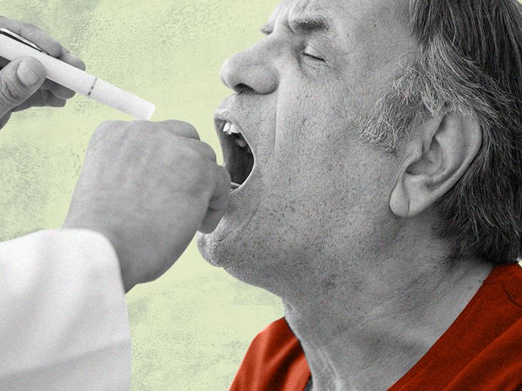 How to treat tongue warts and other mouth warts