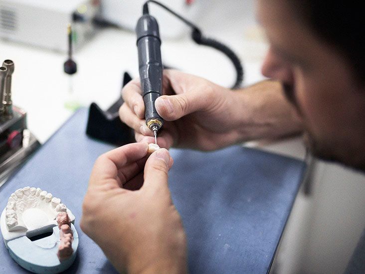 Psoriatic arthritis and dental implants Procedure and risks