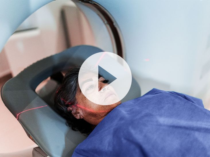 Mri And Multiple Sclerosis Mri And Multiple Sclerosis