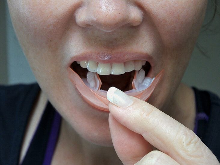 How to whiten your teeth naturally: 6 home remedies