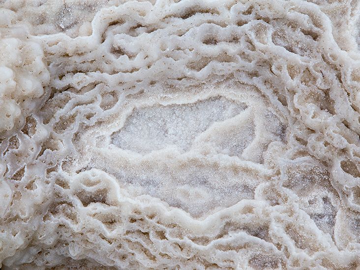 リンゴ酢と乾癬