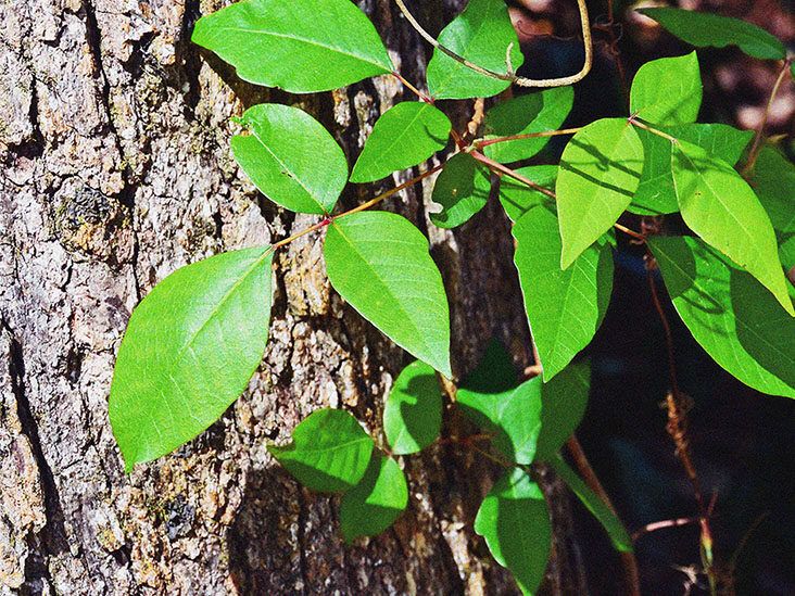Poison ivy: Home remedies and how to recognize it