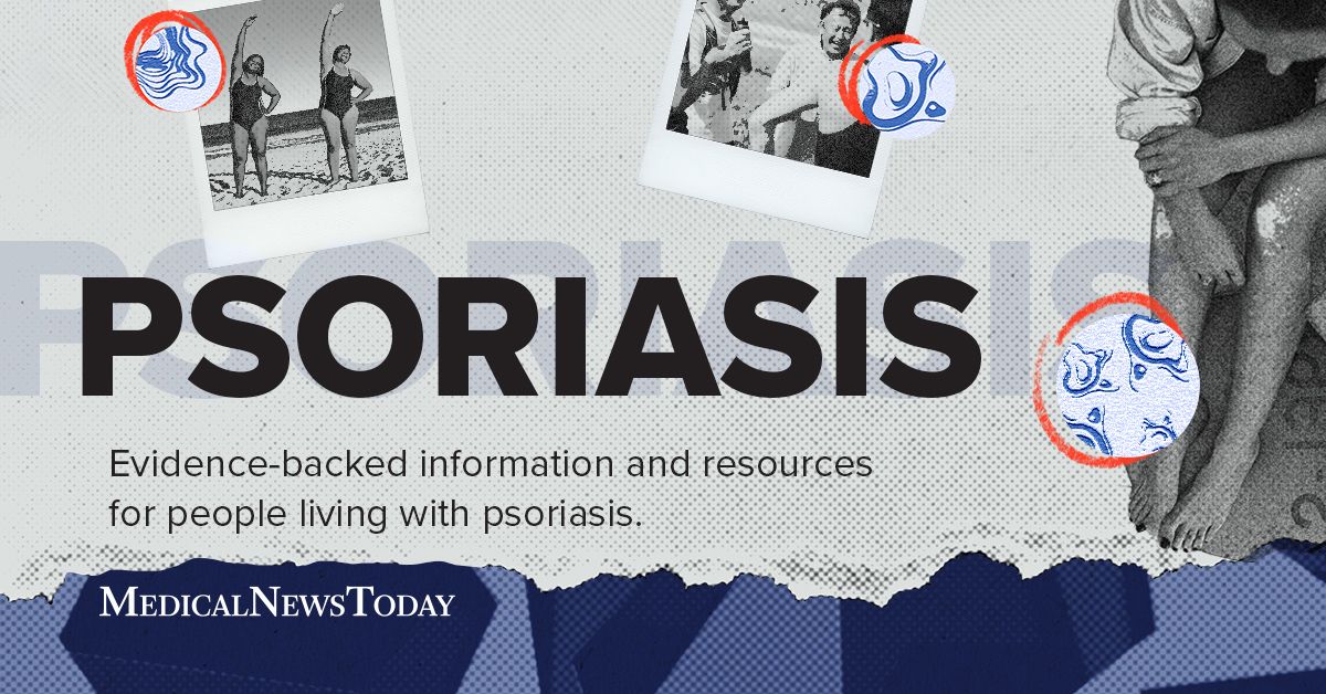 Psoriasis: Resources On Types, Causes, Treatments, And More