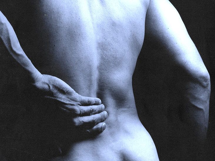 Tailbone pain: Causes, diagnosis, and relief