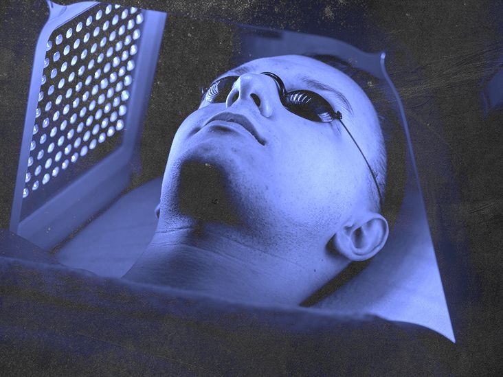 How effective is ultraviolet light therapy for atopic dermatitis?