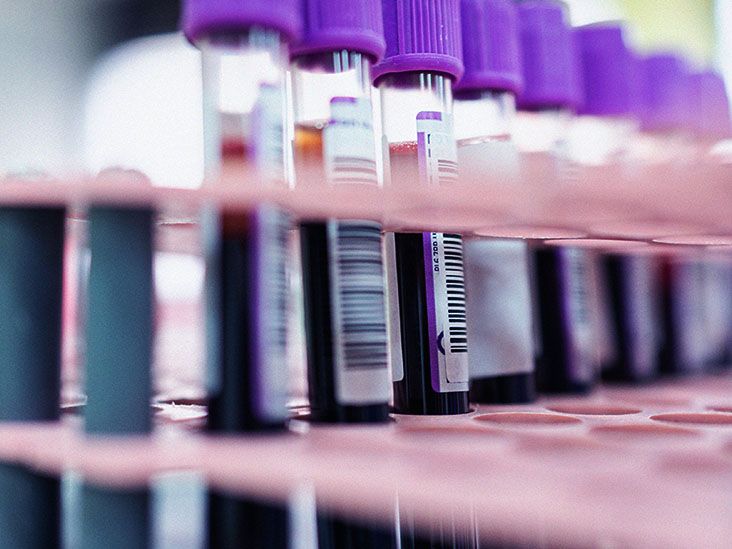 Can undetectable HIV become detectable? What to know