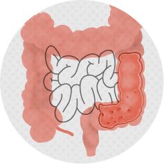 The Science of Ulcerative Colitis thumbnail image
